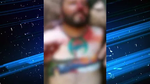 Imagem ilustrativa da notícia: VÍDEO: Homem fica gravemente ferido após ser atacado por pitbull no Pará